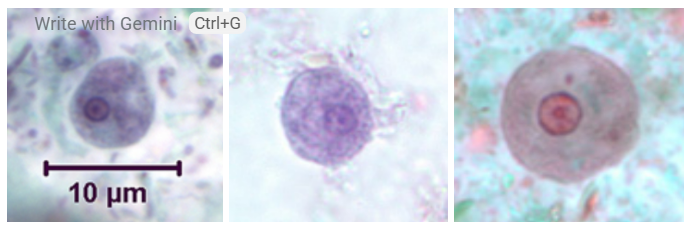 <ol><li><p>Entamoeba hartmanni</p></li><li><p>Trophozoite</p></li></ol><p></p>