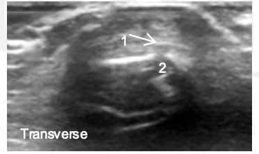 <p>What is 1 and 2?</p>