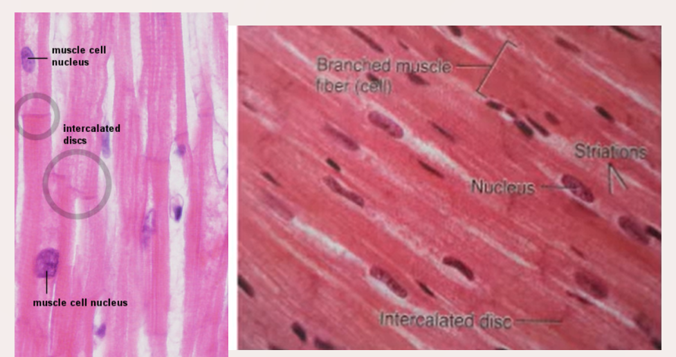 <p>labelled cardiac muscle</p><p>[intercalated discs are the faint lines that connect the fibres]</p>