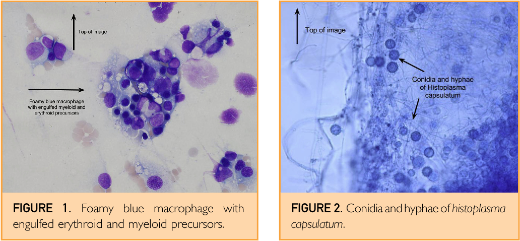 <p>Histoplasma capsulatum</p>
