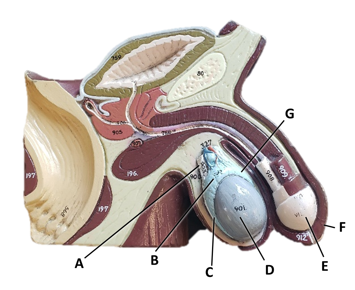 <p><span>Identify the structure/organ labeled with the letter F.</span></p>