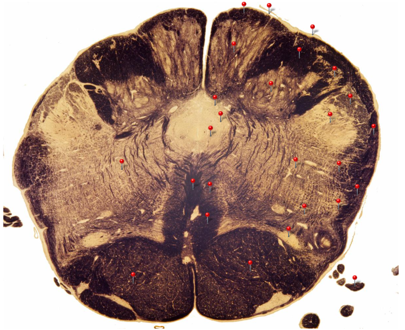 term image
