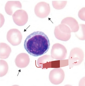 <p>Microcyte </p>