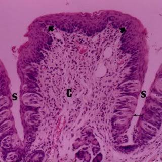 <p>vallate papillae</p>