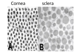 <p><span style="background-color: inherit; line-height: 20.7px; color: windowtext;">Scleral vs corneal collagen:</span><span style="line-height: 20.7px; color: windowtext;">&nbsp;</span></p><p class="Paragraph SCXO248590468 BCX0" style="text-align: left;"><span style="background-color: inherit;">The cornea has narrow, uniformly packed collagen fibrils allowing transparency, while the sclera has larger, randomly arranged fibrils causing white opacity</span><span style="line-height: 23px;">&nbsp;</span></p>