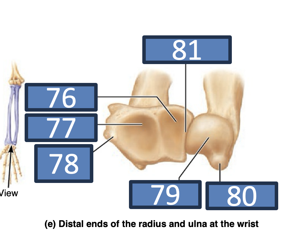 <p>head of ulna</p>
