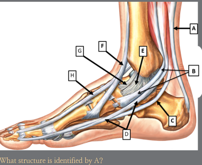 <p>A?</p>