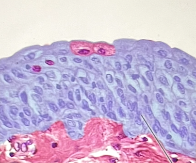 <p>identify the highlighted epithelium found lining the urinary bladder</p>