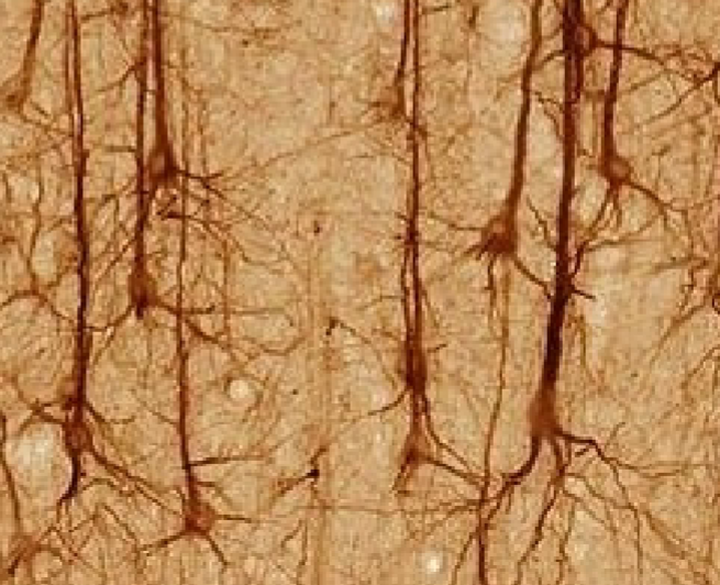 <p>cerebral cortex of the brain</p>