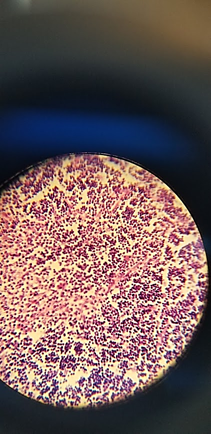 <p>what is this a sample of?</p>