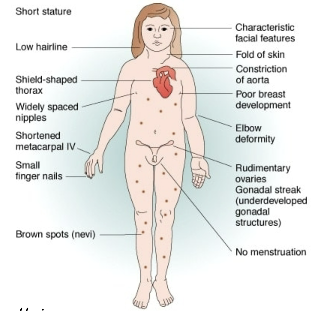 <p>Female phenotype</p>