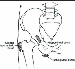 <ul><li><p><span style="color: red;"><strong>Trochanteric bursa</strong></span></p><ul><li><p>Often d/t <span style="color: red;"><strong>inflammatory arthritis</strong></span>, it can also be d/t trauma and repetitive activity</p></li></ul></li></ul><p></p>