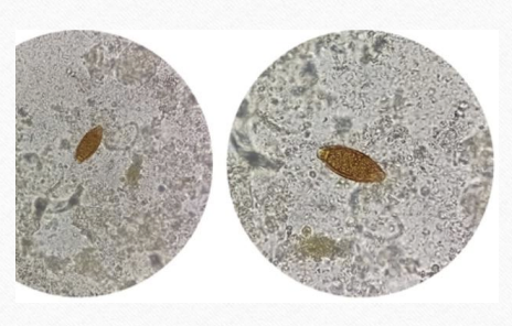 <p>seen in stool microscopic examination</p>