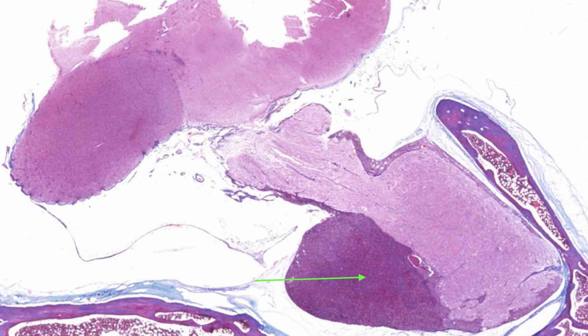 <p><strong>Identify the indicated endocrine organ at the pointer.</strong></p>
