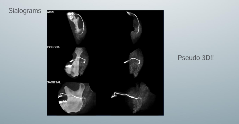 <p>-not used often</p>