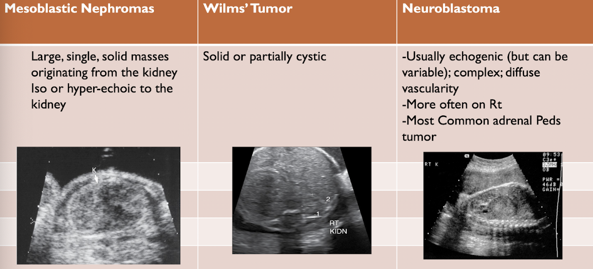 <p>renal tumors</p>