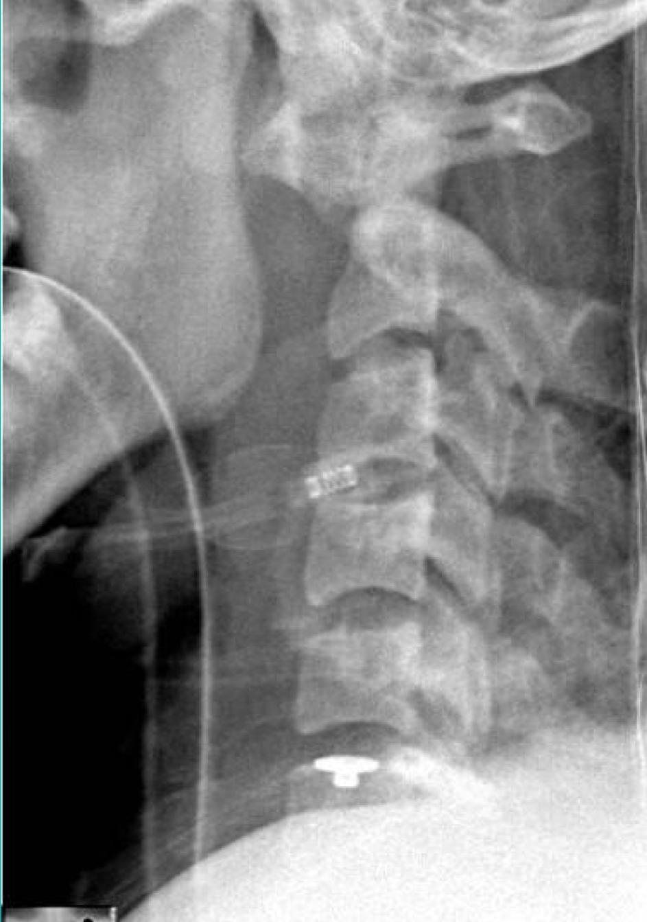 <p>Concerning the most significant Dx, is this considered stable or unstable</p>