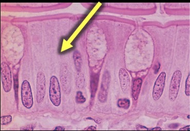 <p>What is the type tissue in this image?</p>