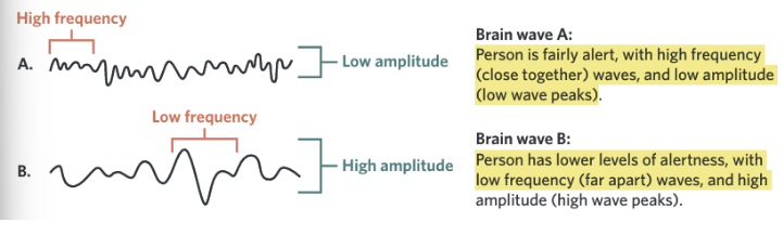 <ul><li><p class="Paragraph SCXO37931850 BCX0" style="text-align: left;"><span style="background-color: inherit; line-height: 20.7px; color: windowtext;">Frequency is the number of brain waves that occur per second</span><span style="line-height: 20.7px; color: windowtext;"> </span></p></li><li><p class="Paragraph SCXO37931850 BCX0" style="text-align: left;"><span style="background-color: inherit; line-height: 20.7px; color: windowtext;">Amplitude is the intensity and height of the brain waves</span><span style="line-height: 20.7px; color: windowtext;"> </span></p></li></ul><p></p>