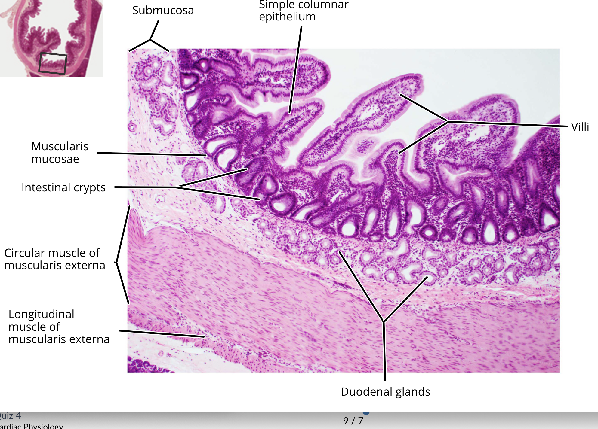 <ul><li><p>mucosa </p></li><li><p>muscularis mucosa </p></li><li><p>submucosa</p></li><li><p>muscularis externa</p></li><li><p>serosa </p></li><li><p><strong>enteroendocrine cell</strong></p></li><li><p><strong>enterocyte</strong></p></li><li><p><strong>paneth cell</strong></p></li><li><p><strong>goblet cells</strong></p></li><li><p><strong>duodenal glands</strong></p></li></ul><p></p>