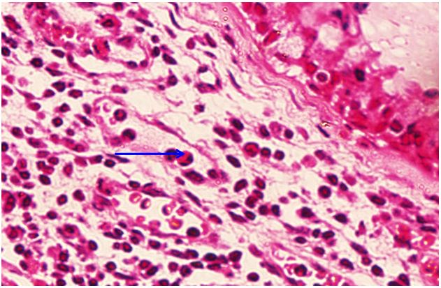 <p>Tế bào gì ?</p>