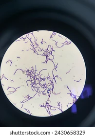 <ul><li><p><span><strong>Cell Shape and Size:</strong> Vegetative cells are typically rod-shaped </span></p></li><li><p><span><strong>Arrangement:</strong> Cells can occur singly, in pairs, or occasionally in short chains.</span></p></li><li><p><span><strong>Spore Morphology:</strong> Endospores are ellipsoidal and centrally or sub-terminally located. They do not cause the cell to swell (non-distending) and enable the bacteria to survive harsh conditions like radiation, desiccation, and extreme temperatures.</span></p></li><li><p><span><strong>Staining:</strong> Gram-positive (retains crystal violet and stains purple).</span></p></li><li><p><span><strong>Motility:</strong> They are motile by means of peritrichous flagella</span></p></li></ul><p></p>
