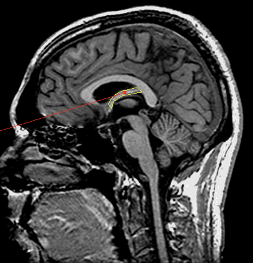 <p>What is the area highlighted called?</p>