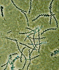 <p>Tight spiral shape of bacteria</p>