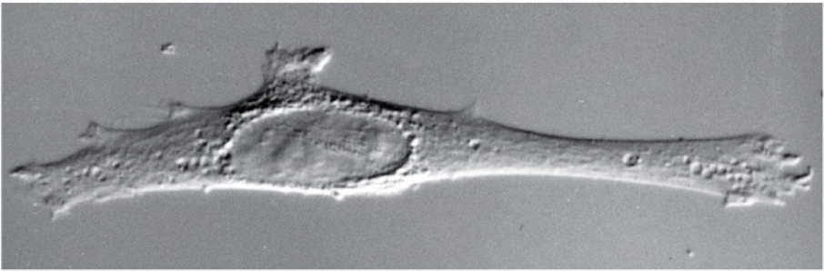 <p>Differential Interference Contrast (DIC) microscopy</p>