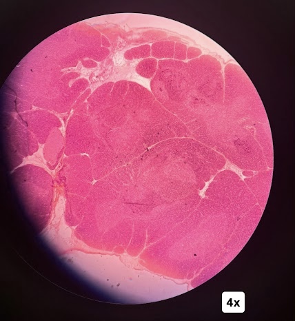 <p>This slide depicts which endocrine gland</p>