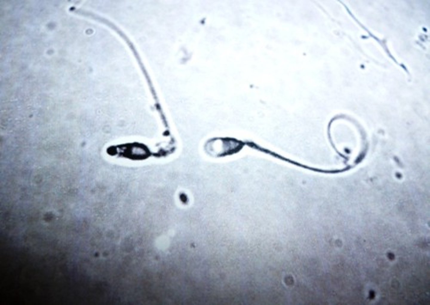 <p>male gamete; spermatozoa</p>