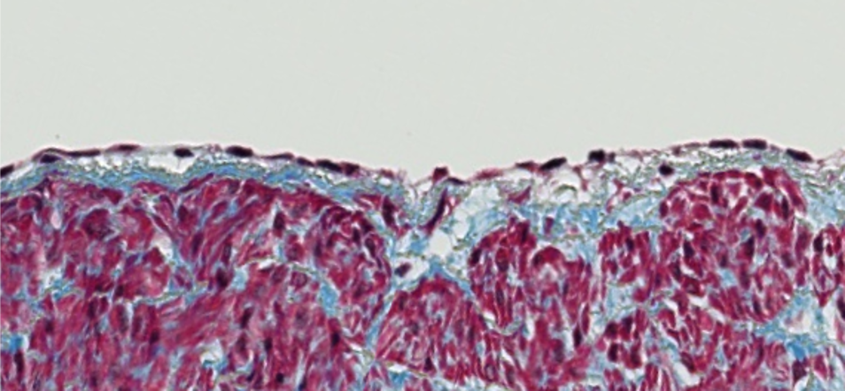 <p><span style="font-family: "Calibri Light";">Which type of epithelium is lining the surface of this tissue?</span></p>