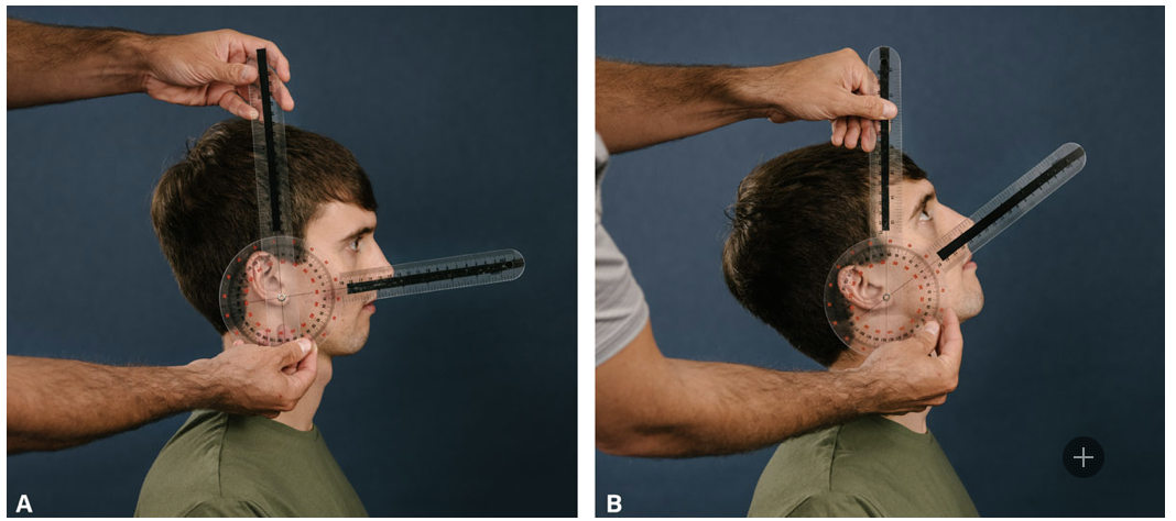<p>Neck Extension</p>