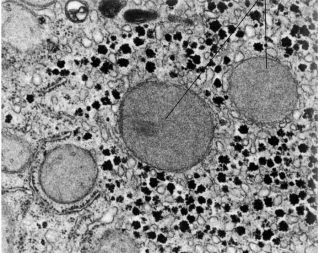<p>Peroxisomes</p>
