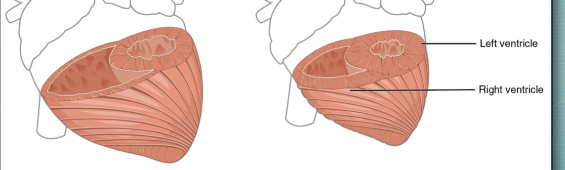 <p>[left ventricle] - [greater resistance in the systemic circuit]</p>