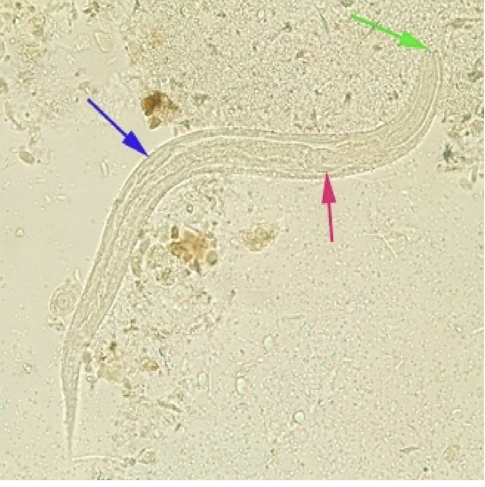 <p>-Worm (rhabditiform larvae)</p><ul><li><p>Short buccal canal</p></li><li><p>Bulbar portion of esophagus</p></li><li><p>Genital primordium</p></li></ul><p></p>