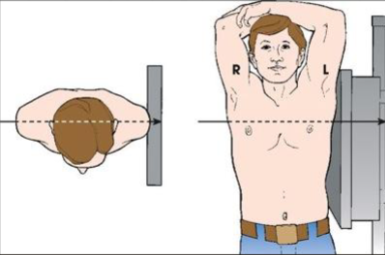 <p>What position and projection is this?</p>