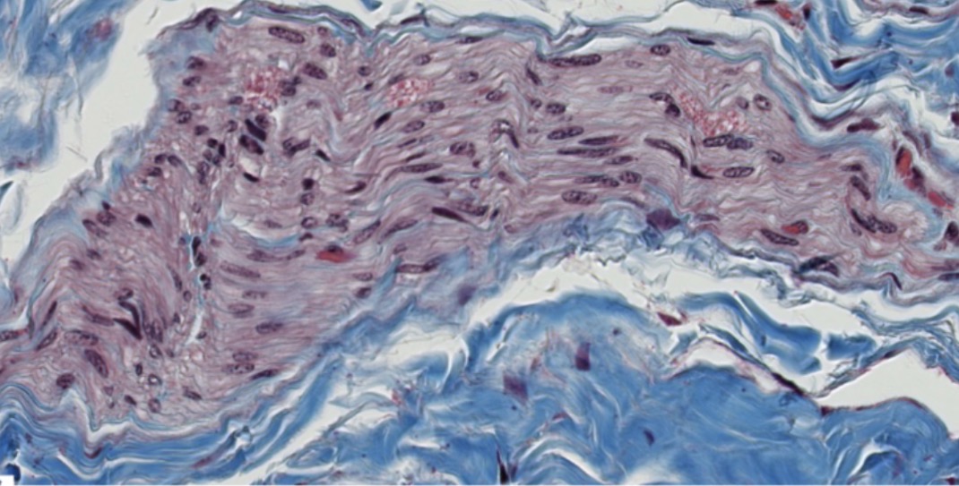<p><span>Is this nerve fascicle myelinated or unmyelinated?</span></p>