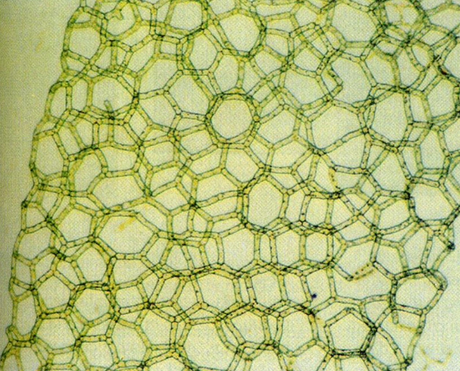 <p>Photo shows a Chlorophyta green algae of the genus Hydrodictyon. Fill in the blanks: Hydrodictyon (water net) green algae is (a: motile / immotile) and (b: unicellular / multicellular / colonial).</p>