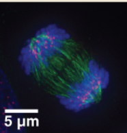 <p>What miotic phase is being shown </p>