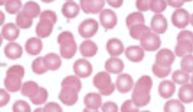 <p>What blood cell is this?</p>