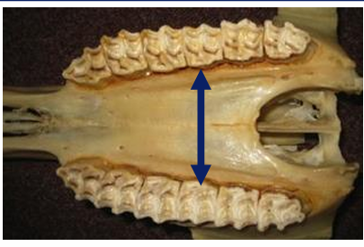 <p>Widest 08-10</p><p>Implications:</p><ul><li><p>Tack</p></li><li><p>Removing buccal overgrowths follow curve</p></li></ul><p></p>