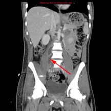 <p>identify the pathology</p>