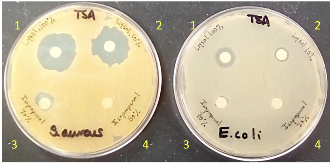 <p>no growth around disc means</p>