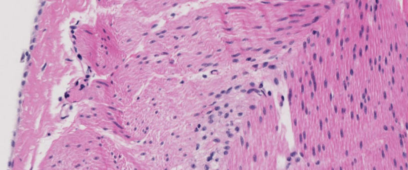 <p>What layers of a tubular organ are shown in the image</p>