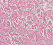 <p>What tissue</p>