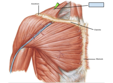 <p>Which structure is unlabeled?</p>