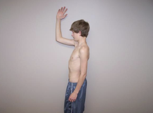 <p>The patient places the forearm on a wall in neutral with elbows flexed and arm in the plane of the scapula or in the sagittal plane. The patient elevates and arm while isometrically externally rotating and horizontally abducting into the wall.</p>