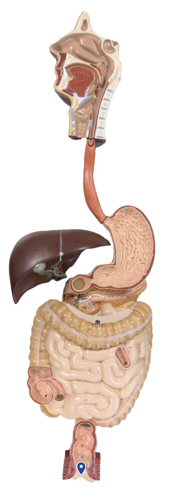 <p>Name this opening.</p>