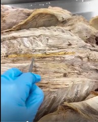 <p>Name the muscle</p>